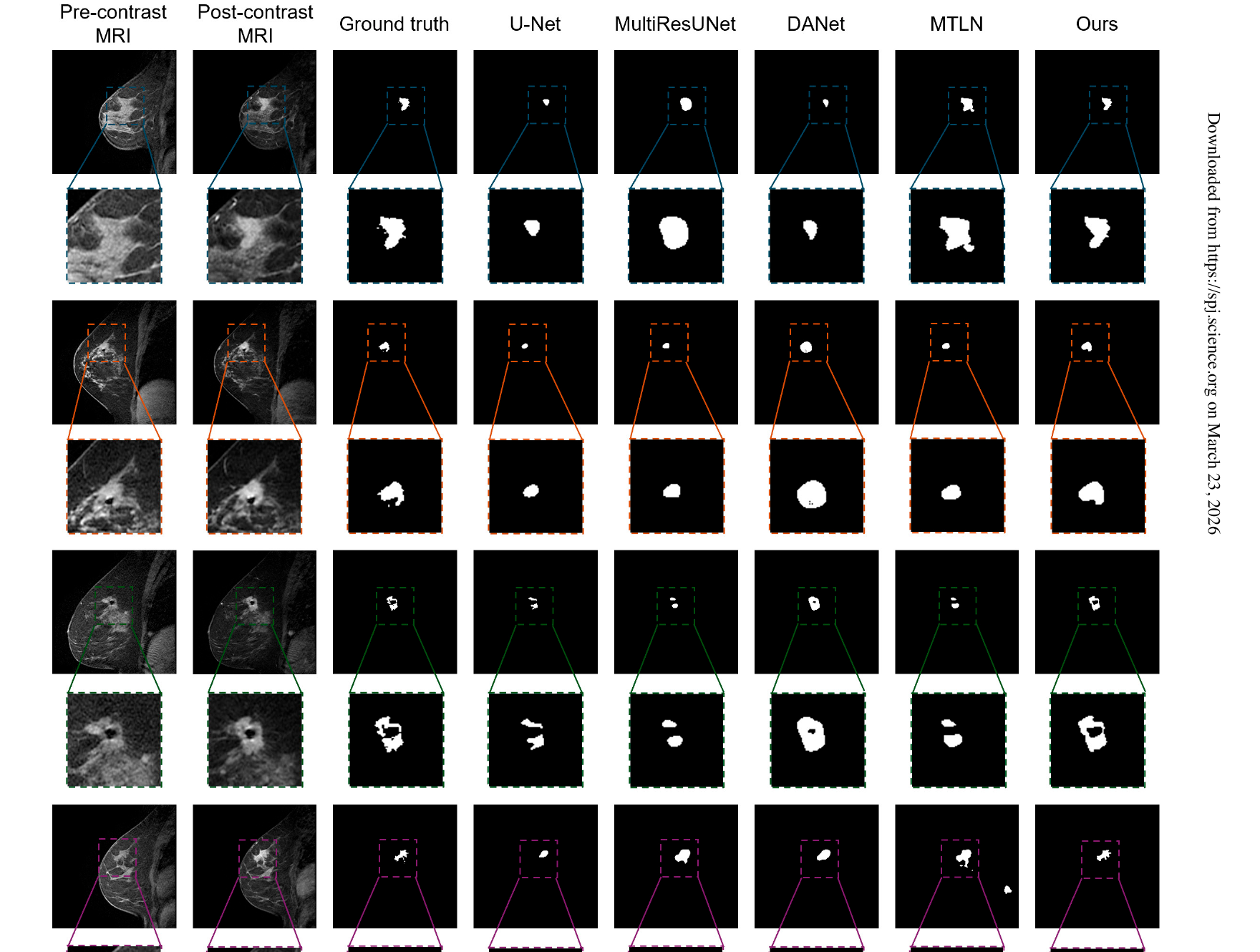 RST2G qualitative comparison: Pre/Post-contrast MRI → Ground truth → baselines → Ours